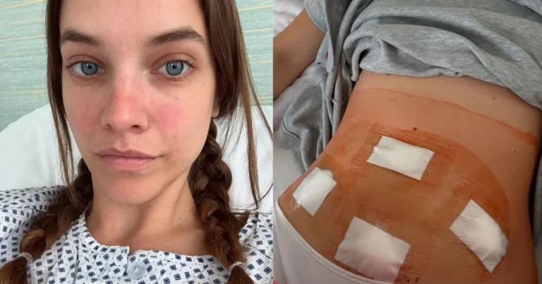 Aos 31 anos, modelo Barbara Palvin detalha diagnóstico de doença incurável: ‘Dor intensa’