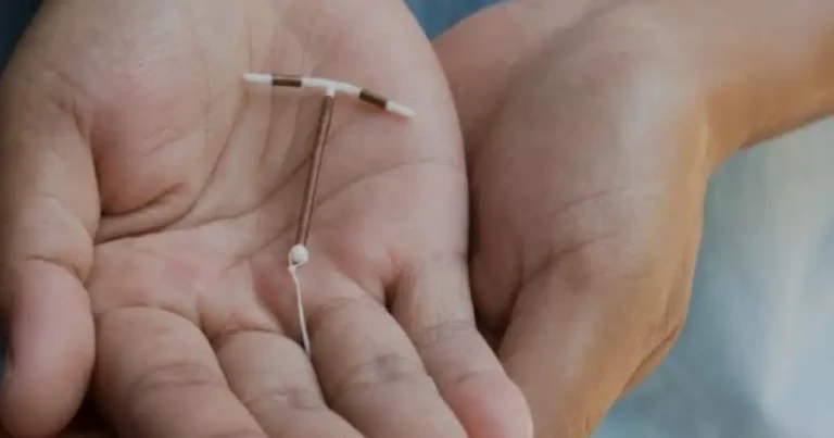Quem pode usar DIU? Tem no SUS? Veja 10 mitos e verdades sobre o método contraceptivo