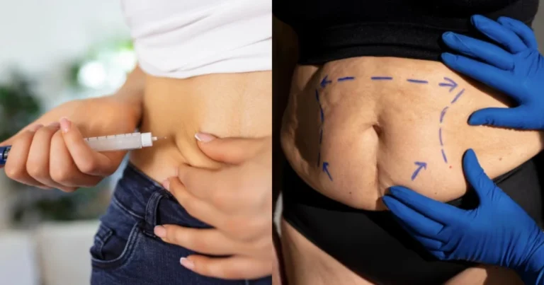 Cirurgia bariátrica e canetas emagrecedoras: médico explica diferenças e indicações
